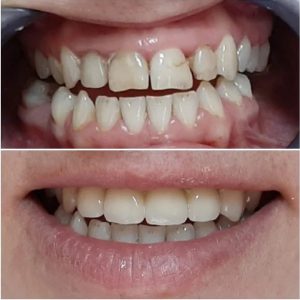 лечение зубов пример работы стоматолога
