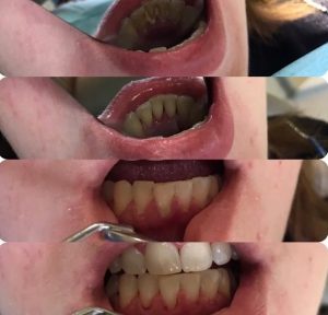 стоматолог пример работ